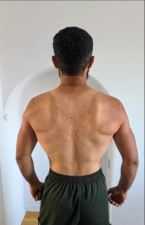 MFF client before and after — 12-month body transformation