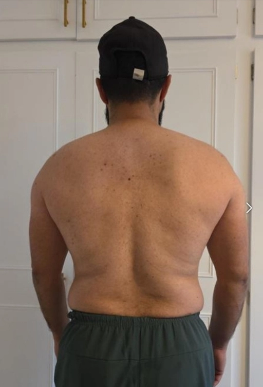 MFF client before and after — 12-month body transformation